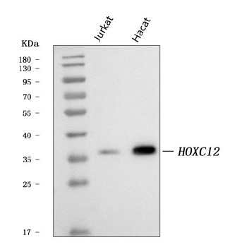 HOXC12 Antibody