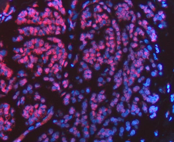 Anti-FIP1L1 Antibody