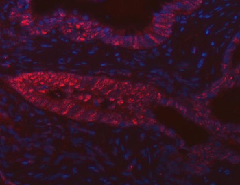 Anti-FIP1L1 Antibody