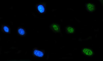 Anti-FIP1L1 Antibody