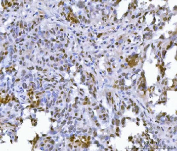 Anti-FIP1L1 Antibody
