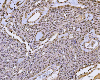 Anti-FIP1L1 Antibody
