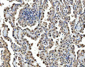 Anti-FIP1L1 Antibody