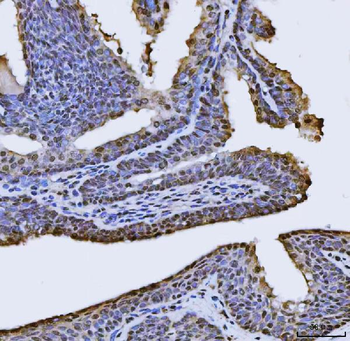 Anti-FIP1L1 Antibody