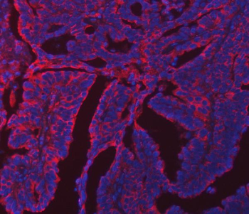 Anti-ERP29 Antibody