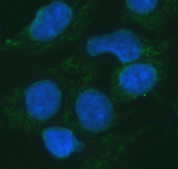 Anti-ERP29 Antibody