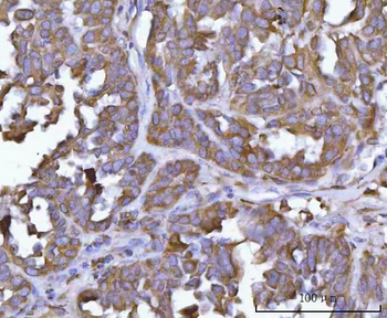 Anti-ERP29 Antibody