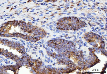 Anti-ERP29 Antibody