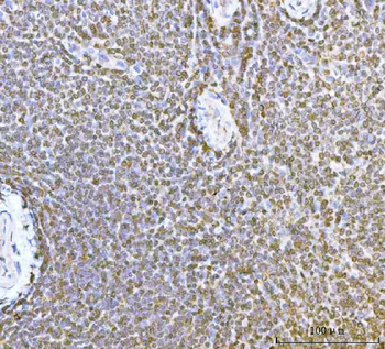 Anti-ERP29 Antibody