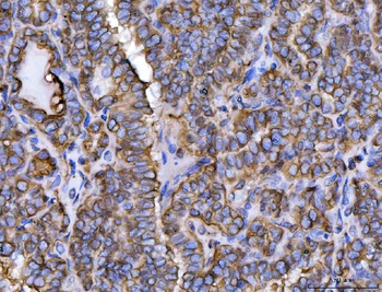 Anti-ERP29 Antibody