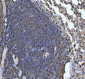 Anti-ERP29 Antibody
