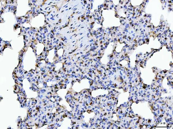Anti-ERP29 Antibody