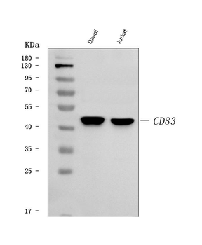 Anti-CD83 Antibody