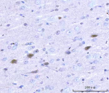 Anti-Adgrg1 Antibody