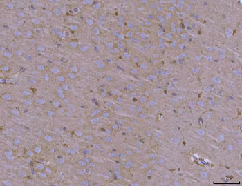 Anti-ADAM22 Antibody
