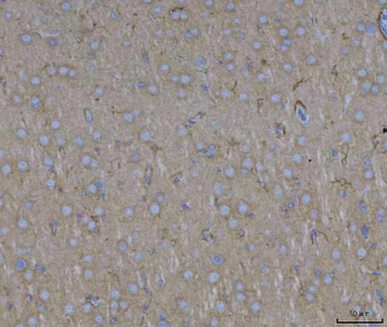 Anti-ADAM22 Antibody