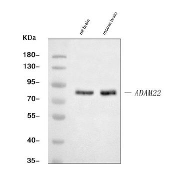 Anti-ADAM22 Antibody