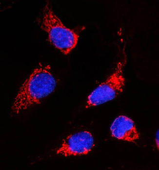 Anti-ACACA Antibody
