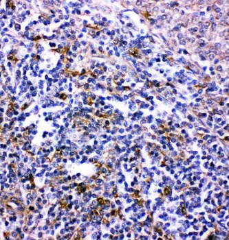 Anti-Bonzo/CXCR6 Antibody