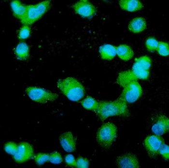 Profilin 2/PFN2 Antibody