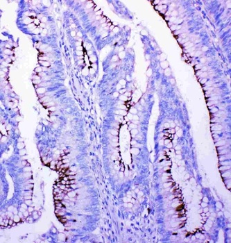 Anti-Profilin 2/PFN2 Antibody