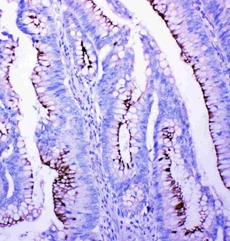 Profilin 2/PFN2 Antibody