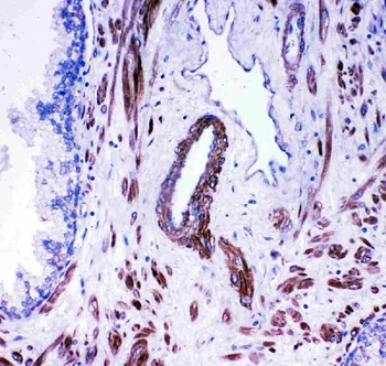 Anti-Angiotensin Converting Enzyme 1/ACE Antibody