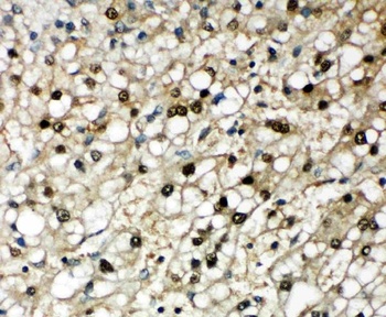 Anti-SBP/SELENBP1 Antibody