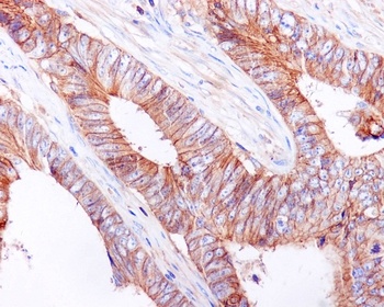 E Cadherin Rabbit Monoclonal Antibody