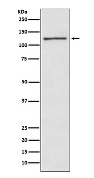 E Cadherin Rabbit Monoclonal Antibody