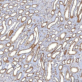 Anti-TRMT61A Antibody