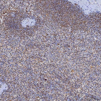 Anti-TRMT61A Antibody