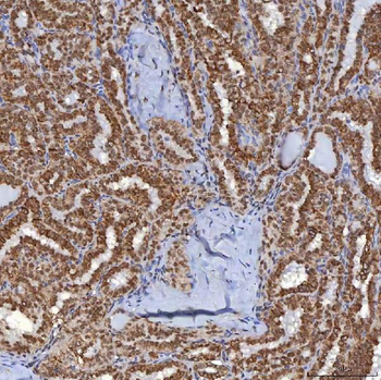 Anti-TRMT61A Antibody