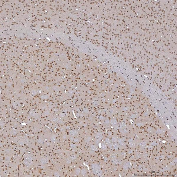 Anti-TRMT61A Antibody