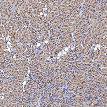 Anti-TRMT61A Antibody