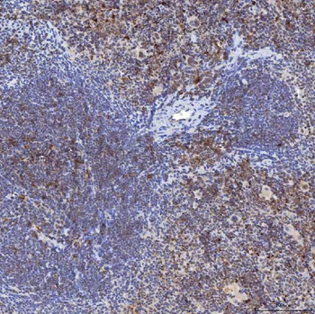 Anti-TRMT61A Antibody