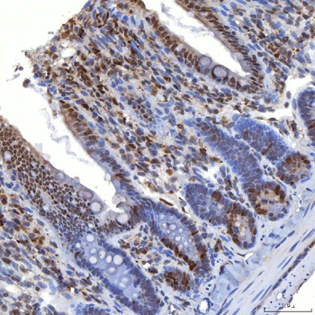 Anti-TRMT61A Antibody