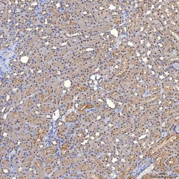 Anti-TRMT61A Antibody