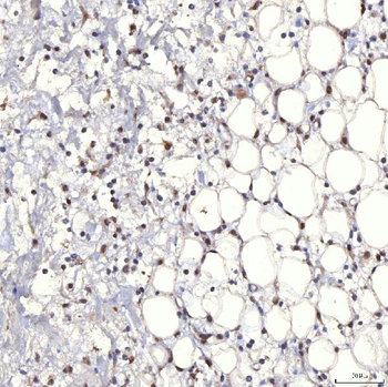 Anti-TRMT61A Antibody