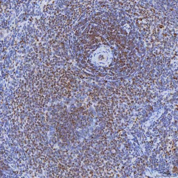 Anti-TRMT61A Antibody