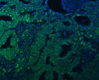 Anti-TRMT61A Antibody