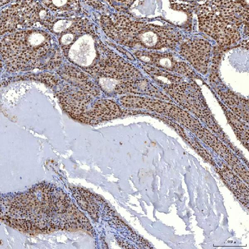 Anti-TRMT61A Antibody