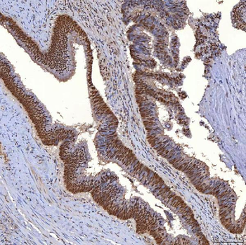 Anti-TRMT61A Antibody