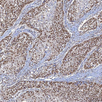 TRMT61A Antibody
