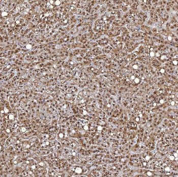 Anti-TRMT61A Antibody