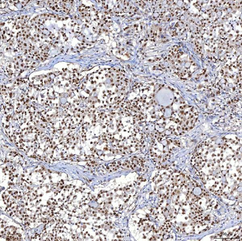 Anti-TRMT61A Antibody