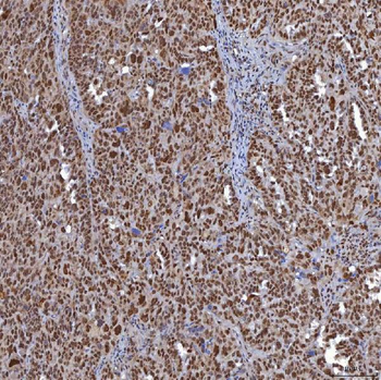 Anti-TRMT61A Antibody