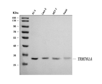TRMT61A Antibody