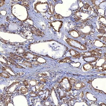 Anti-PIG3/TP53I3 Antibody