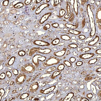 Anti-PIG3/TP53I3 Antibody